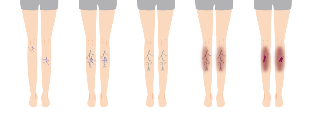 パソコン用の画像