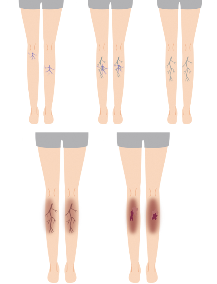 スマートフォン用の画像